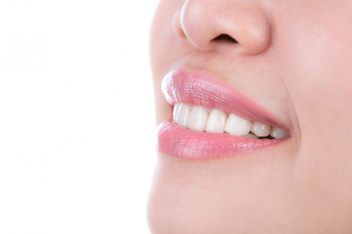 Teeth Straighten Options