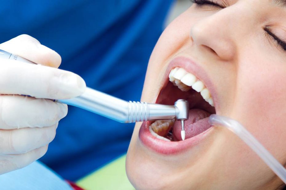 dental implants cost Australia